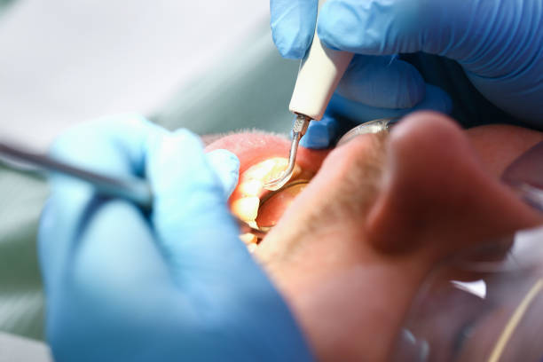 Best Emergency Dentist for Special Needs Patients in Upper Saddle River, NJ