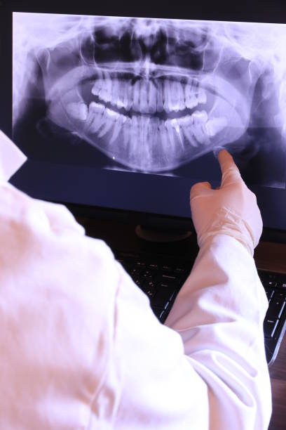 Best Emergency Dental Care for Abscessed Tooth in Upper Saddle River, NJ